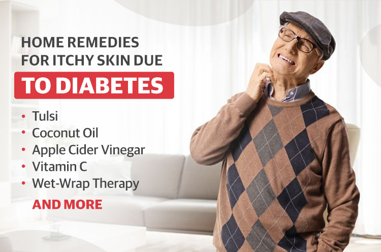 Home-Remedies-for-Itchy-Skin-Due-to-Diabetes