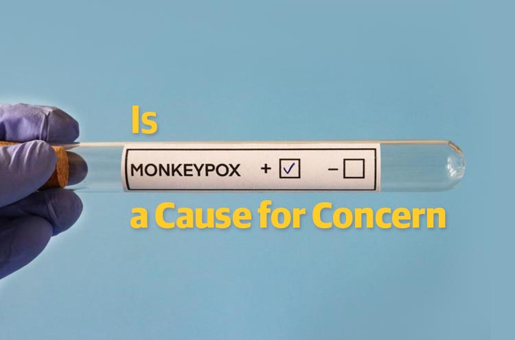 Is Monkeypo a Cause for Concern