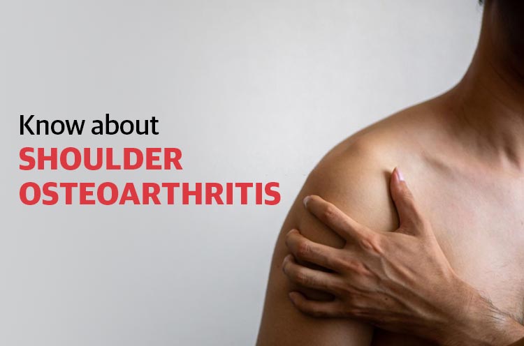 Shoulder Osteoarthritis