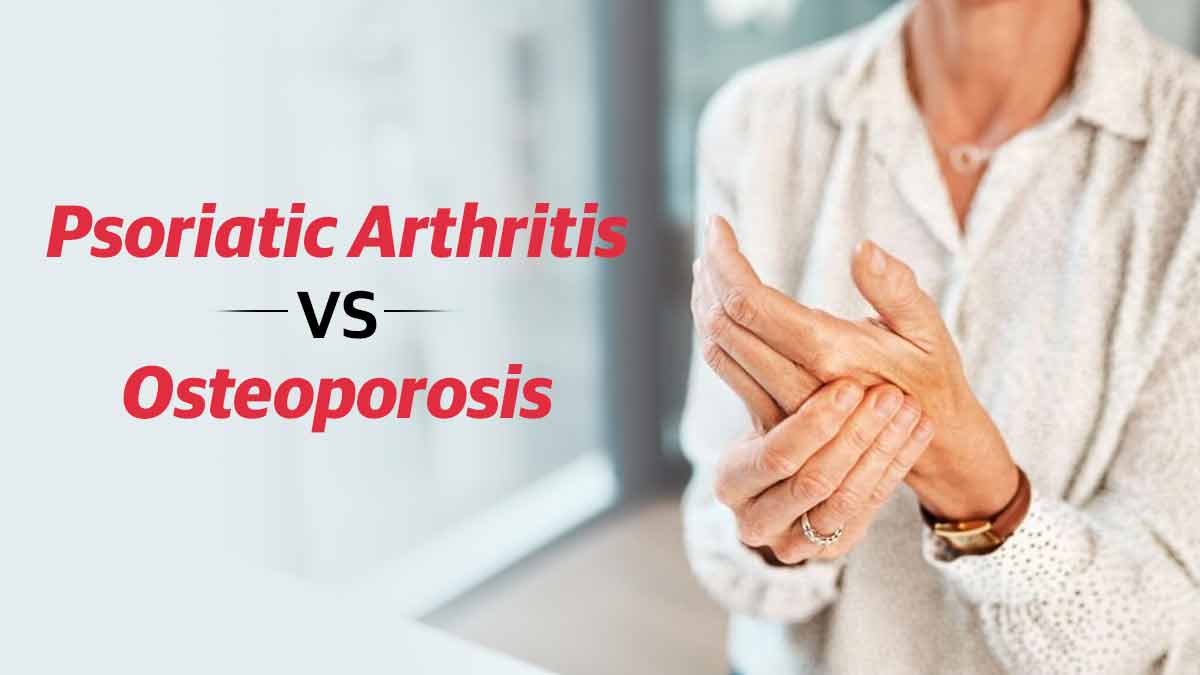 Psoriatic Arthritis vs Osteoporosis